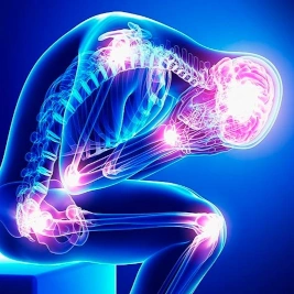 Fibromialgia